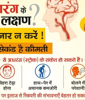 अधरंग के लक्षण दिखें तो एक मिनट भी इंतज़ार न करें, हर सेकंड है कीमती” — डॉ. संदीप गोयल